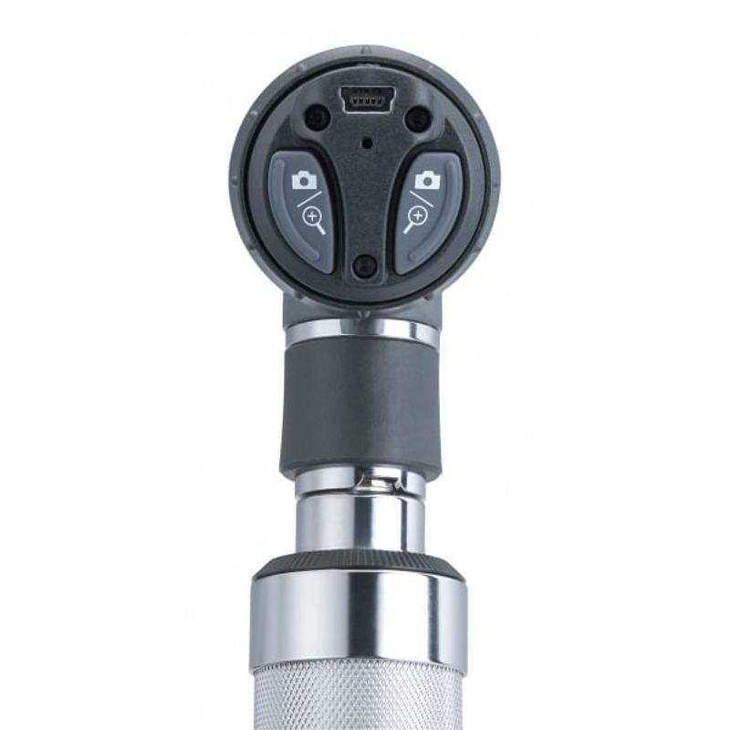 Otoscopio-Macroview---Welch-Allyn---Digital-23820-Center-Medical
