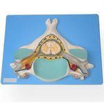 quinta-vertebra-cervical-com-medula-espinhal-e-nervos.centermedical.com.br