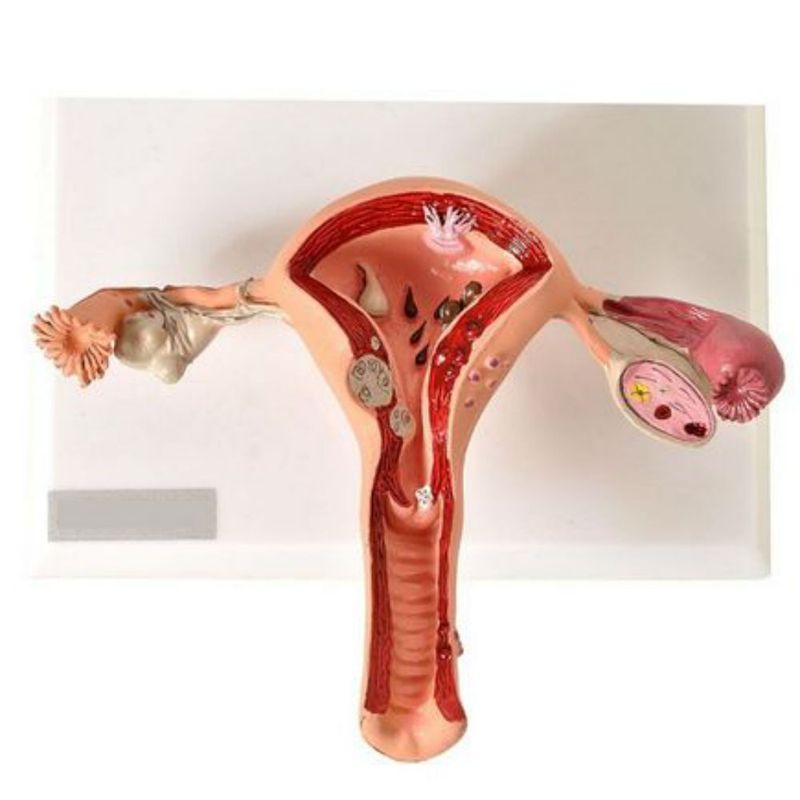 utero-c-trompas-patologico-anatomic..centermedical.com.br