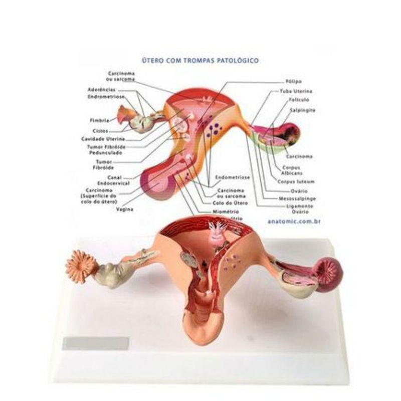 utero-c-trompas-patologico-anatomic...centermedical.com.br