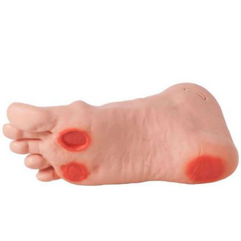 modelo-avancado-de-pe-diabetico-anatomic...centermedical.com.br