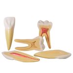 dentes-ampliados-anatomic-canino-incisivo-molar.centermedical.com.br