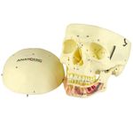 cranio-classico-com-mandibula-aberta..centermedical.com.br