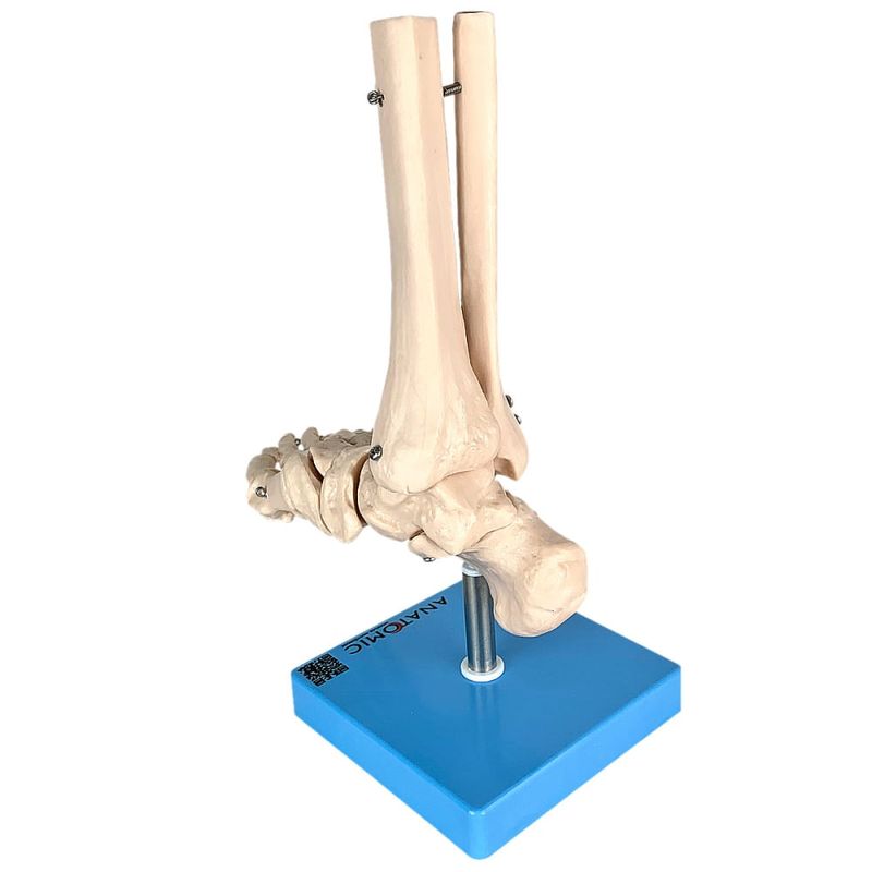 Esqueleto-do-Pe-com-Ossos-Tornozelo-Center-Medical