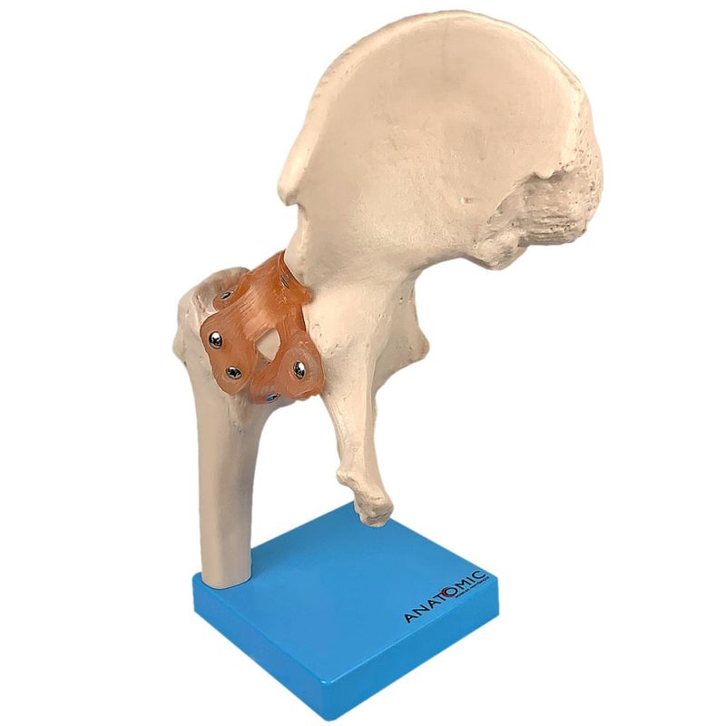 Articulacao-do-Quadril-com-Ligamentos-Center-Medical