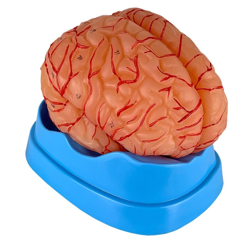 cerebro-com-arterias-em-09-partes-anatomic...centermedical.com.br
