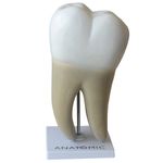 dente-molar-ampliado-08-partes-com-evolucao-da-carie.centermedical.com.br