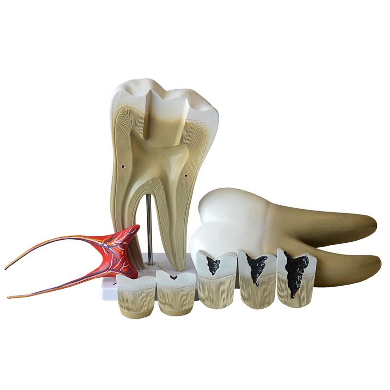 dente-molar-ampliado-08-partes-com-evolucao-da-carie..centermedical.com.br