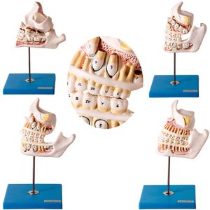 Modelo do Desenvolvimento da Dentição