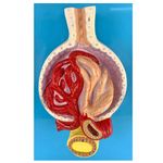 Rim-Glomerulos-Center-Medical