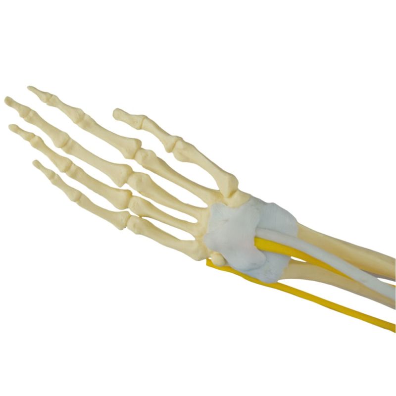 Braco-com-Ossos-Musculos-Ligamentos-e-Nervos-Center-Medical