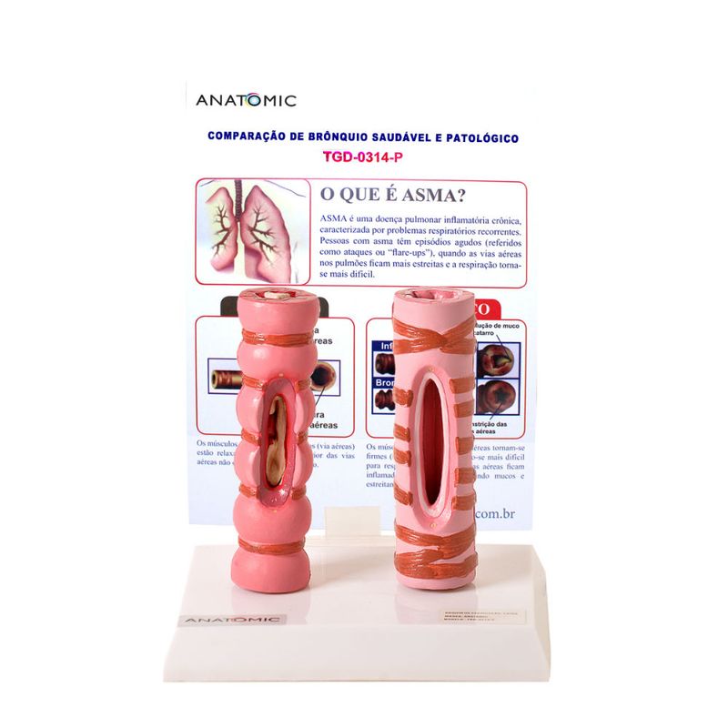 comparacao-de-bronquio-saudavel-e-patologico.centermedical.com.br