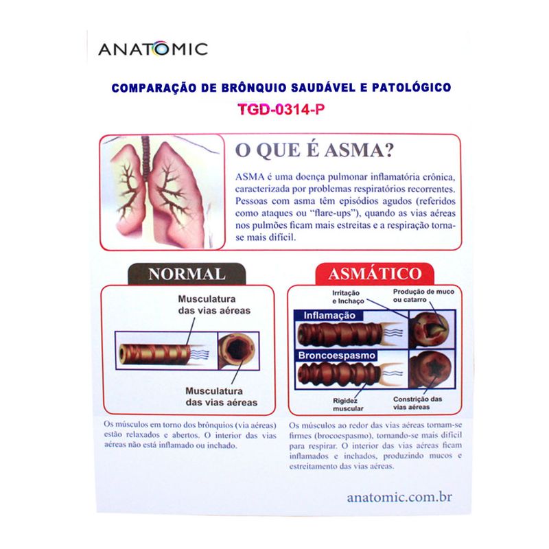 comparacao-de-bronquio-saudavel-e-patologico...centermedical.com.br
