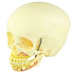 Cranio-Infantil-com-Mandibula-Aberta-Center-Medical