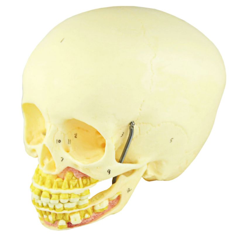 Cranio-Infantil-com-Mandibula-Aberta-Center-Medical