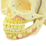 Cranio-Infantil-com-Mandibula-Aberta-Center-Medical