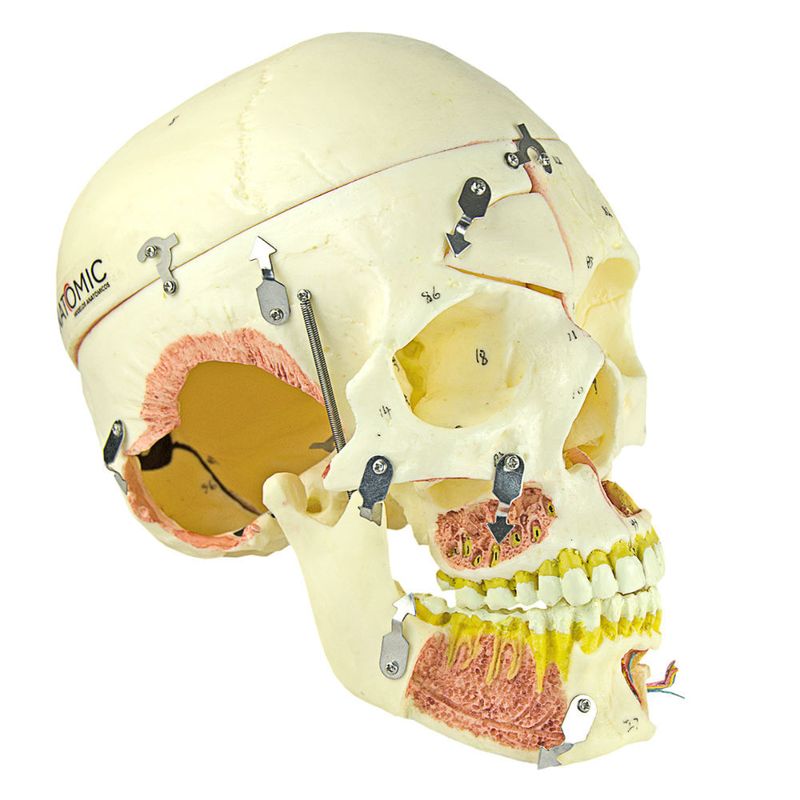 Cranio-com-Vasos-Sanguineos-e-Nervos-Numerado-em-10-Partes-Center-Medical