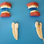 Patologia-Dentaria-com-12-Pecas-Center-Medical