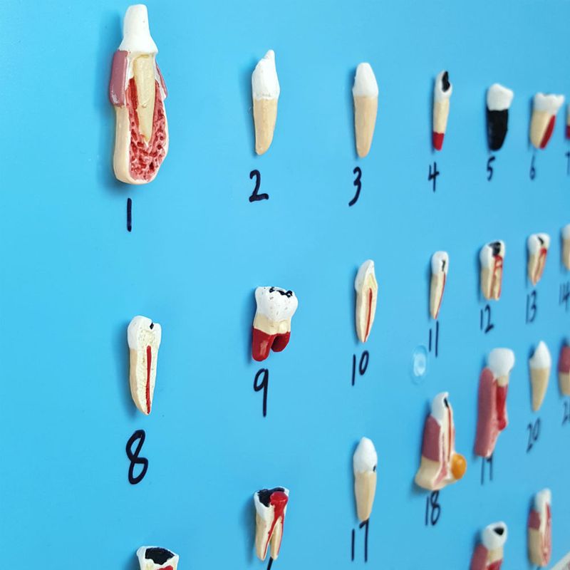 Patologia-Dentaria-com-25-Pecas-Center-Medical