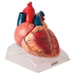 Coracao-Ampliado-Luxo-em-3-Partes-Center-Medical