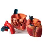 Coracao-Ampliado-Luxo-em-3-Partes-Center-Medical