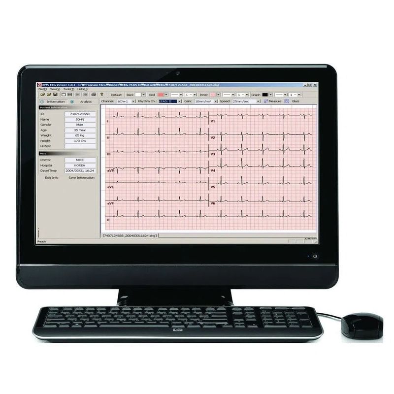 eletrocardiografo-ecg-12-canais-bionet-cardiocare-2000-bf....centermedical.com.br