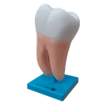 dente-molar-ampliado-anatomic-saudavel-e-com-caries.centermedical.com.br
