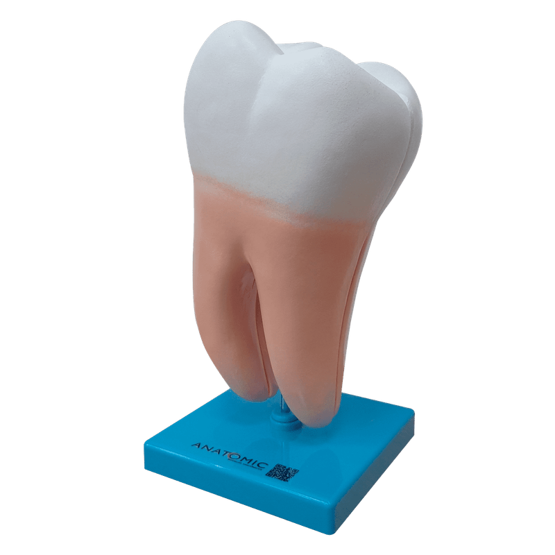 dente-molar-ampliado-anatomic-saudavel-e-com-caries.centermedical.com.br