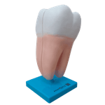 dente-molar-ampliado-anatomic-saudavel-e-com-caries.centermedical.com.br1