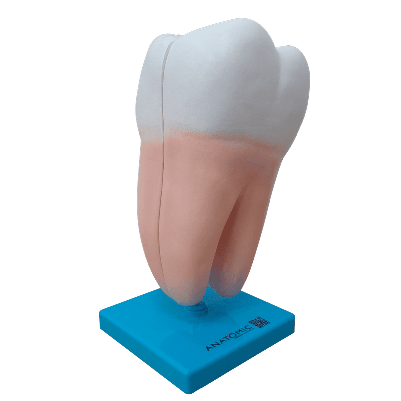 dente-molar-ampliado-anatomic-saudavel-e-com-caries.centermedical.com.br1