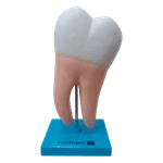 dente-molar-ampliado-anatomic-saudavel-e-com-caries.centermedical.com.br4