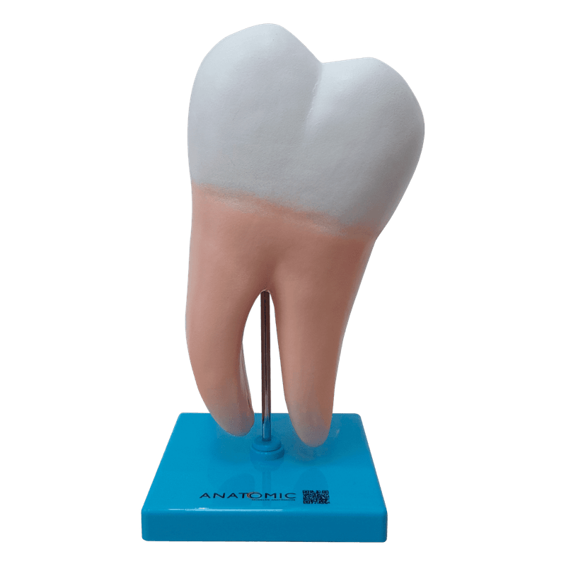 dente-molar-ampliado-anatomic-saudavel-e-com-caries.centermedical.com.br4