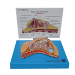modelo-de-mama-com-patologias-anatomic.centermedical.com.br