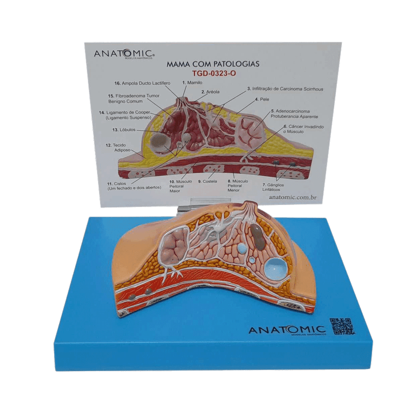 modelo-de-mama-com-patologias-anatomic.centermedical.com.br