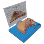 modelo-de-mama-com-patologias-anatomic.centermedical.com.br1