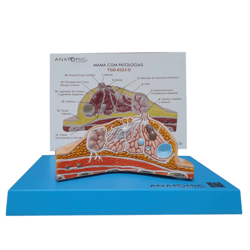 modelo-de-mama-com-patologias-anatomic.centermedical.com.br2