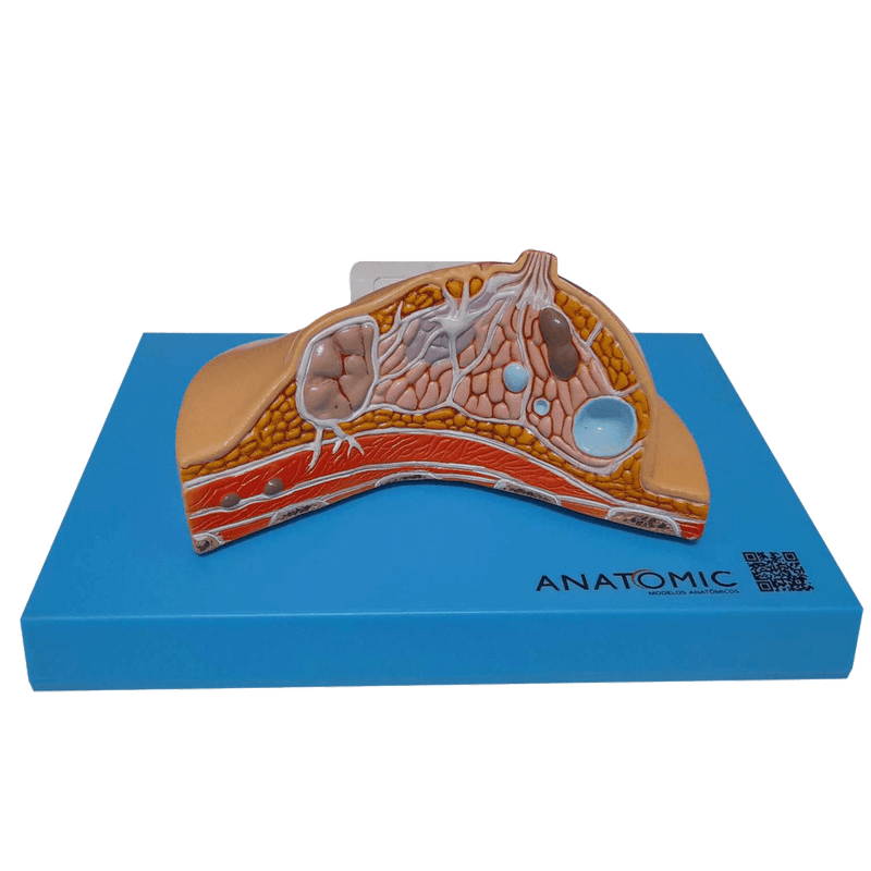modelo-de-mama-com-patologias-anatomic.centermedical.com.br5