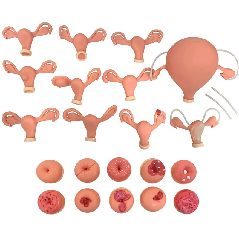 Simulador-Ginecologico-com-Utero-Saudavel-e-Patologicos-Center-Medical