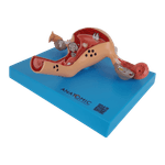 Utero-com-Trompas-Patologico-Center-Medical