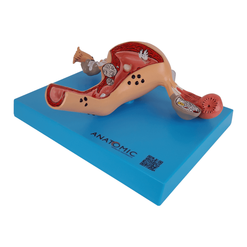 Utero-com-Trompas-Patologico-Center-Medical