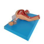 Utero-com-Trompas-Patologico-Center-Medical