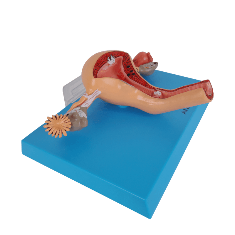 Utero-com-Trompas-Patologico-Center-Medical