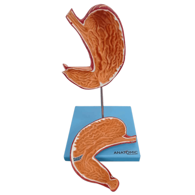 Estomago-Luxo-em-2-partes-Center-Medical