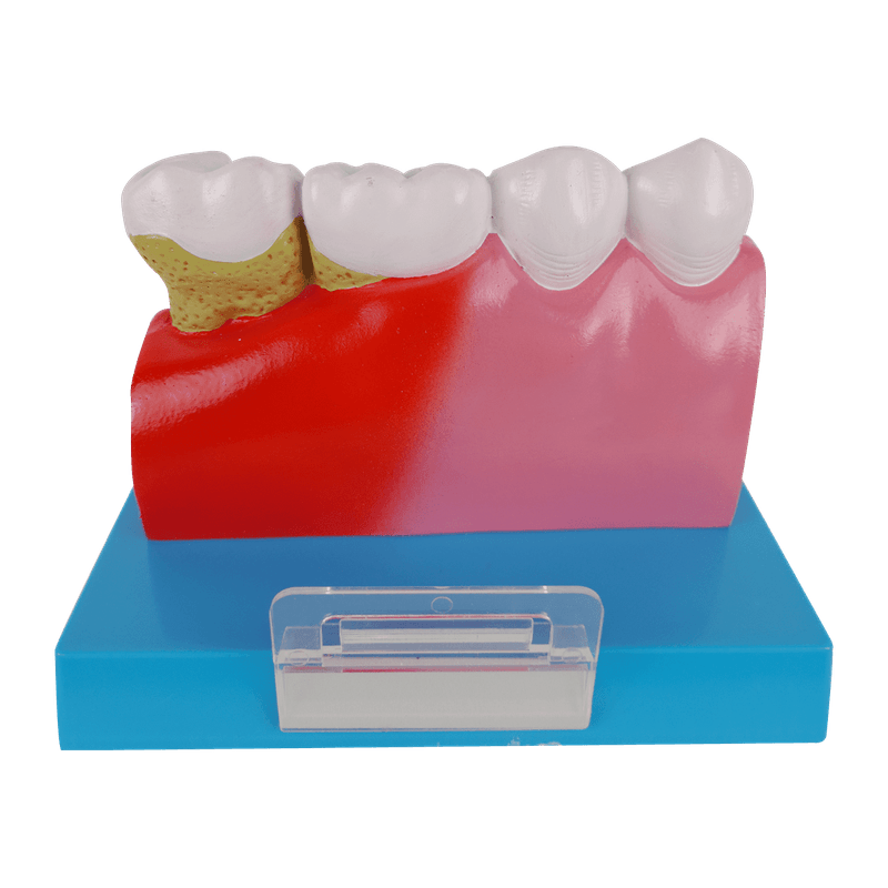 Patologia-dos-Dentes-com-Placa-Explicativa-Center-Medical