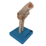 Articulacao-do-Cotovelo-com-Ligamentos-Center-Medical