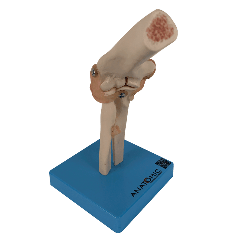 Articulacao-do-Cotovelo-com-Ligamentos-Center-Medical