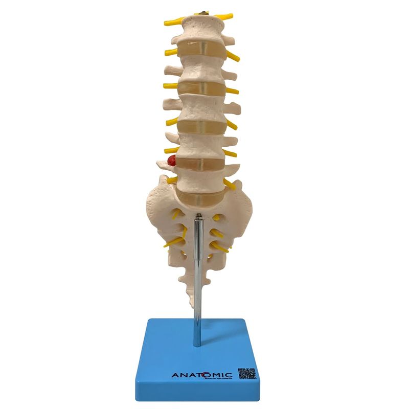 Coluna-Vertebral-Lombar-Center-Medical