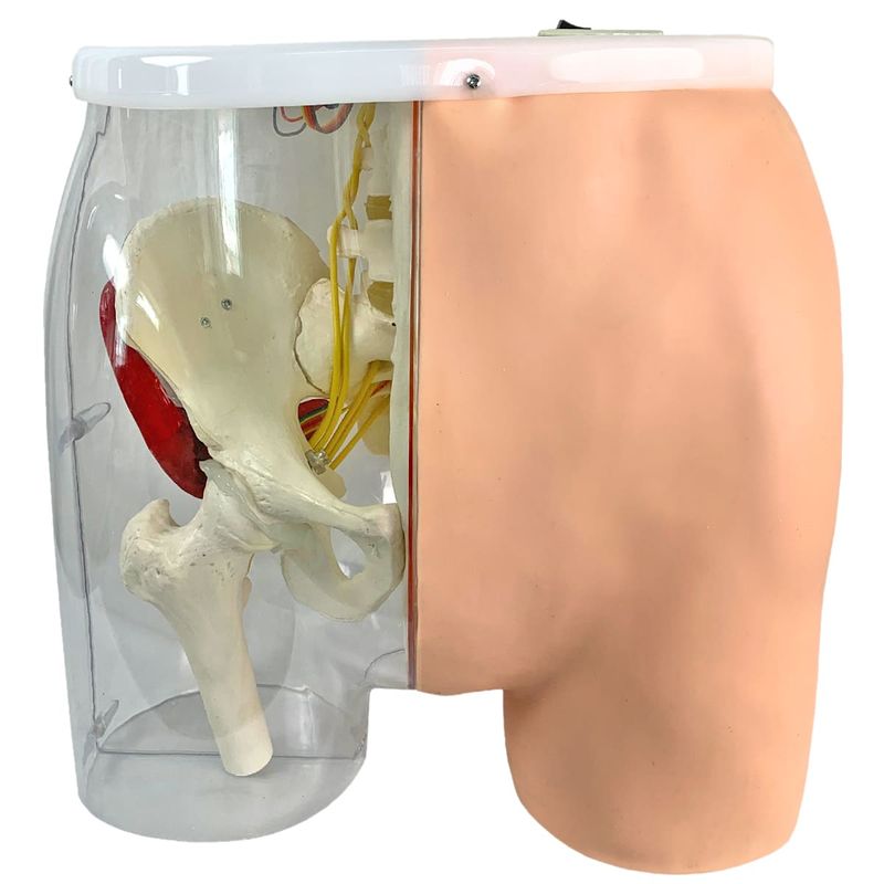 Simulador-para-Treino-de-Injecao-Intramuscular-no-Gluteo-com-Visualizacao-da-Estrutura-Interna-e-Dispositivo-de-Sinalizacao-de-Advertencia-Center-Medical