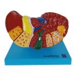 Figado-com-Patologia-Center-Medical