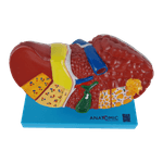 Figado-com-Patologia-Center-Medical